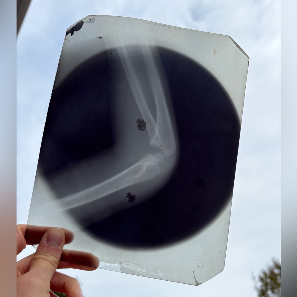 X-Ray joint - Vintage